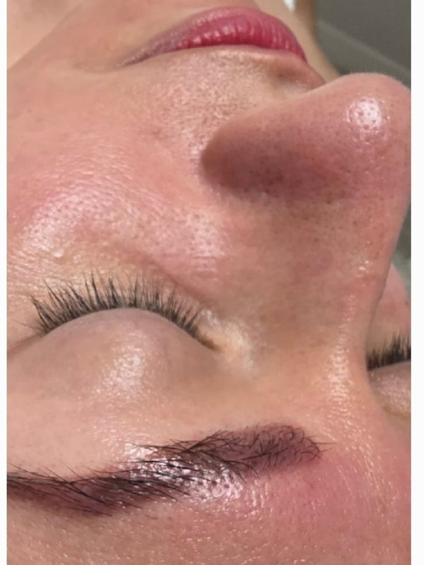 Pore refinement — After