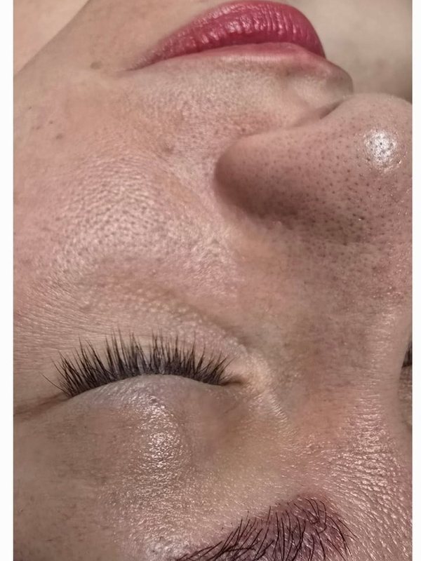 Pore refinement — Before